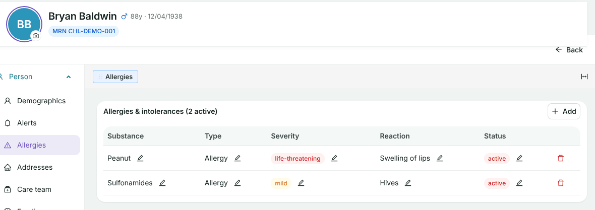 Bryan Baldwin's Allergies tab listing Peanut (life-threatening, swelling of lips, active) and Sulfonamides (mild, hives, active)