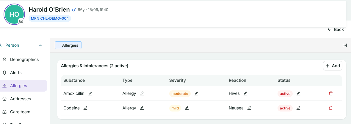 Harold O'Brien's Allergies tab listing Amoxicillin (moderate, hives, active) and Codeine (mild, nausea, active)